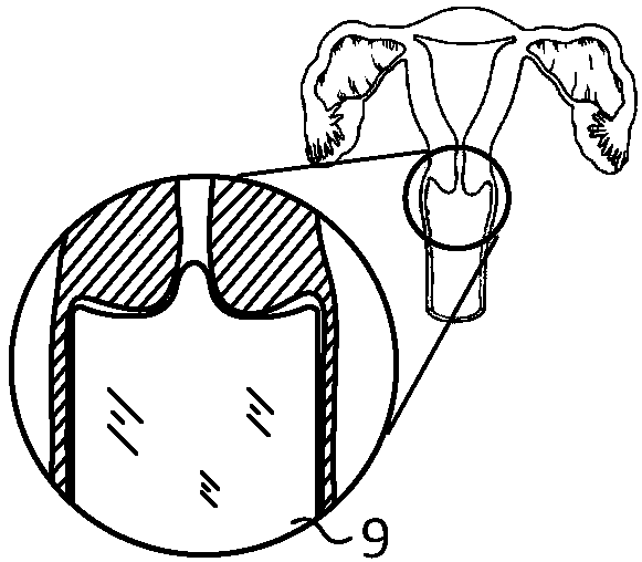 Photodynamic therapy system for cervical lesions based on integration of diagnosis and treatment