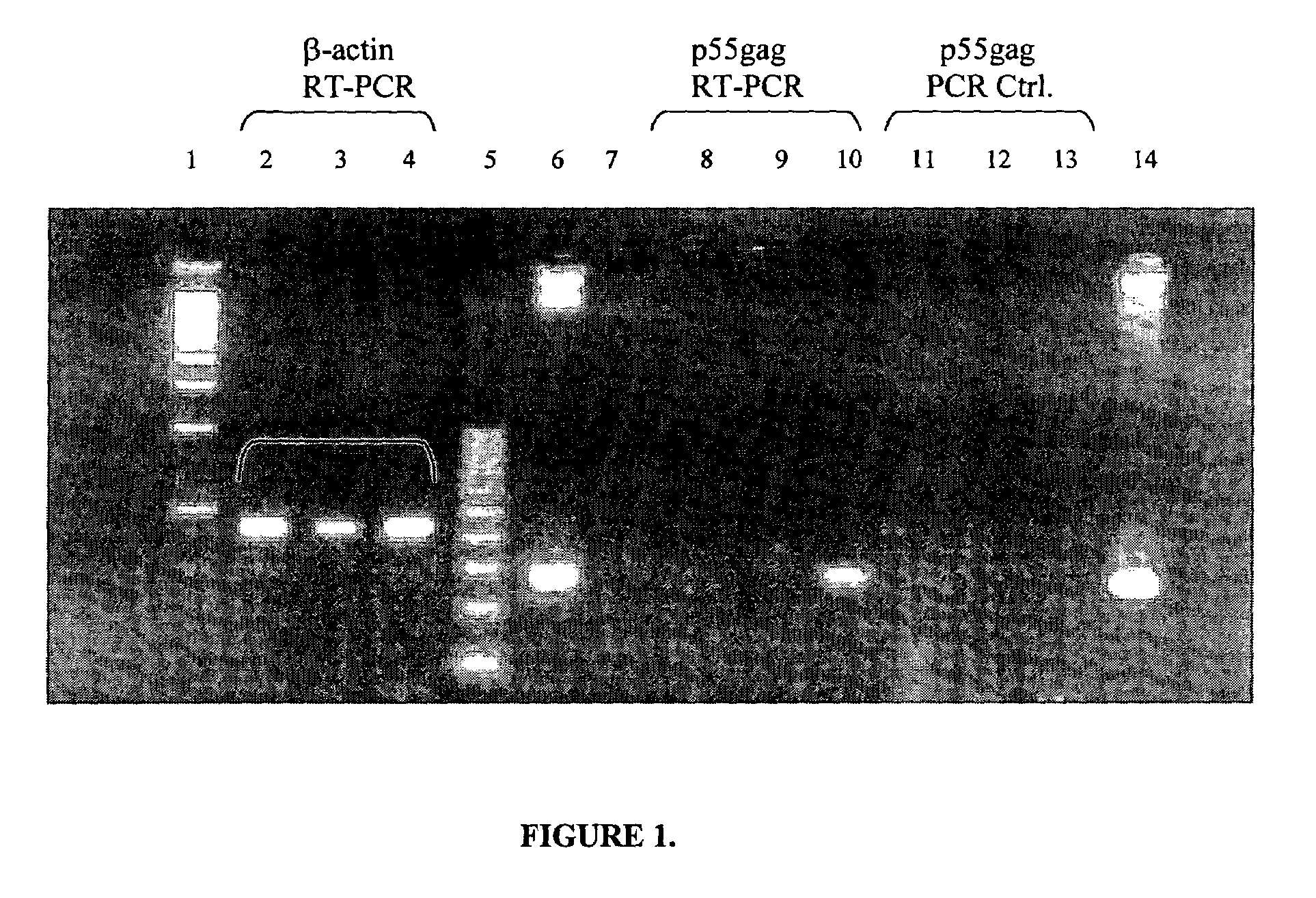 Microparticle-based transfection and activation of dendritic cells