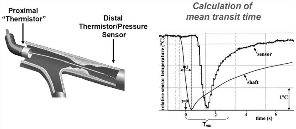 Coronary artery microcirculation detection and coronary artery analysis system