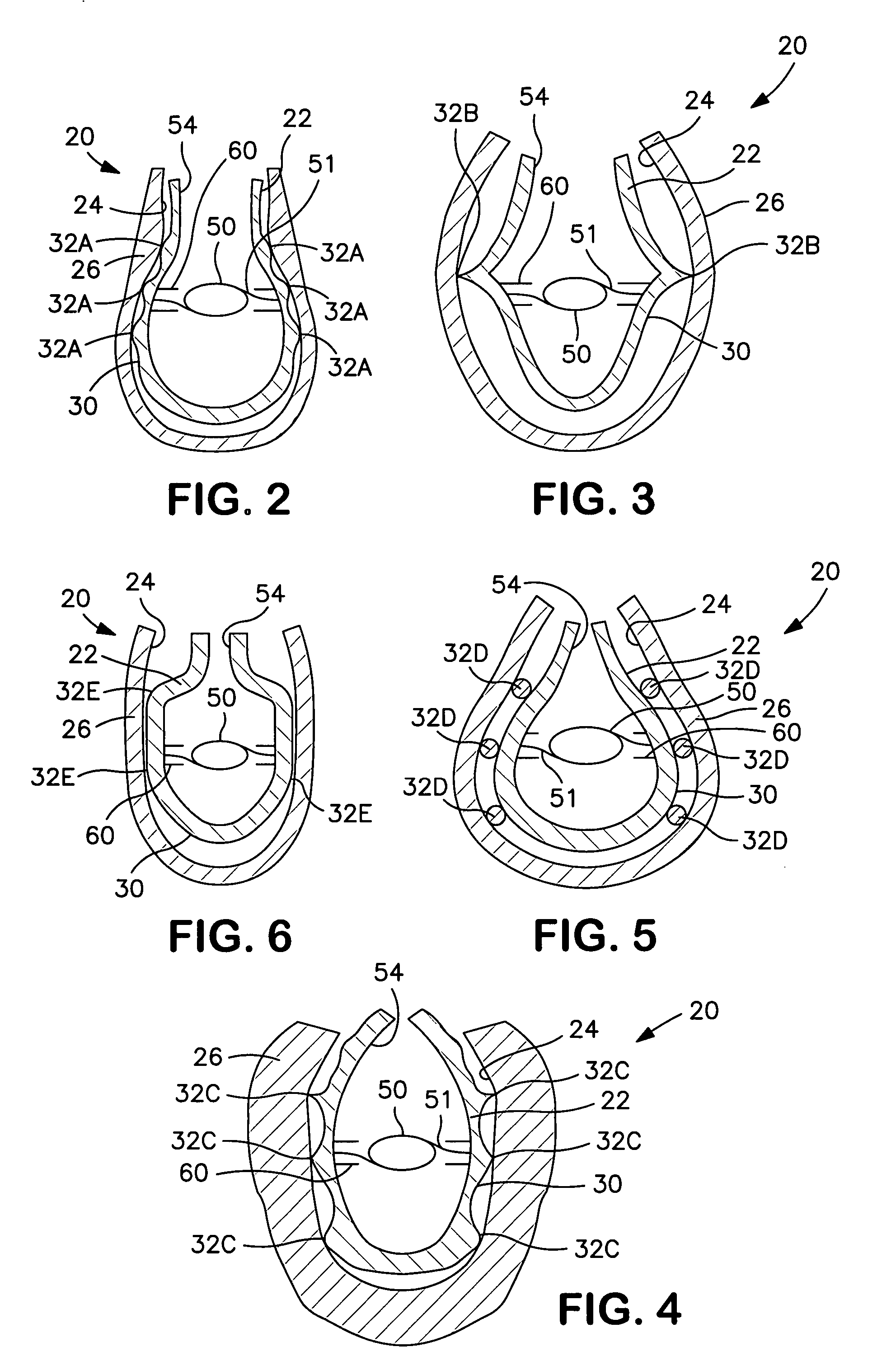 Interior bag for a capsular bag and injector