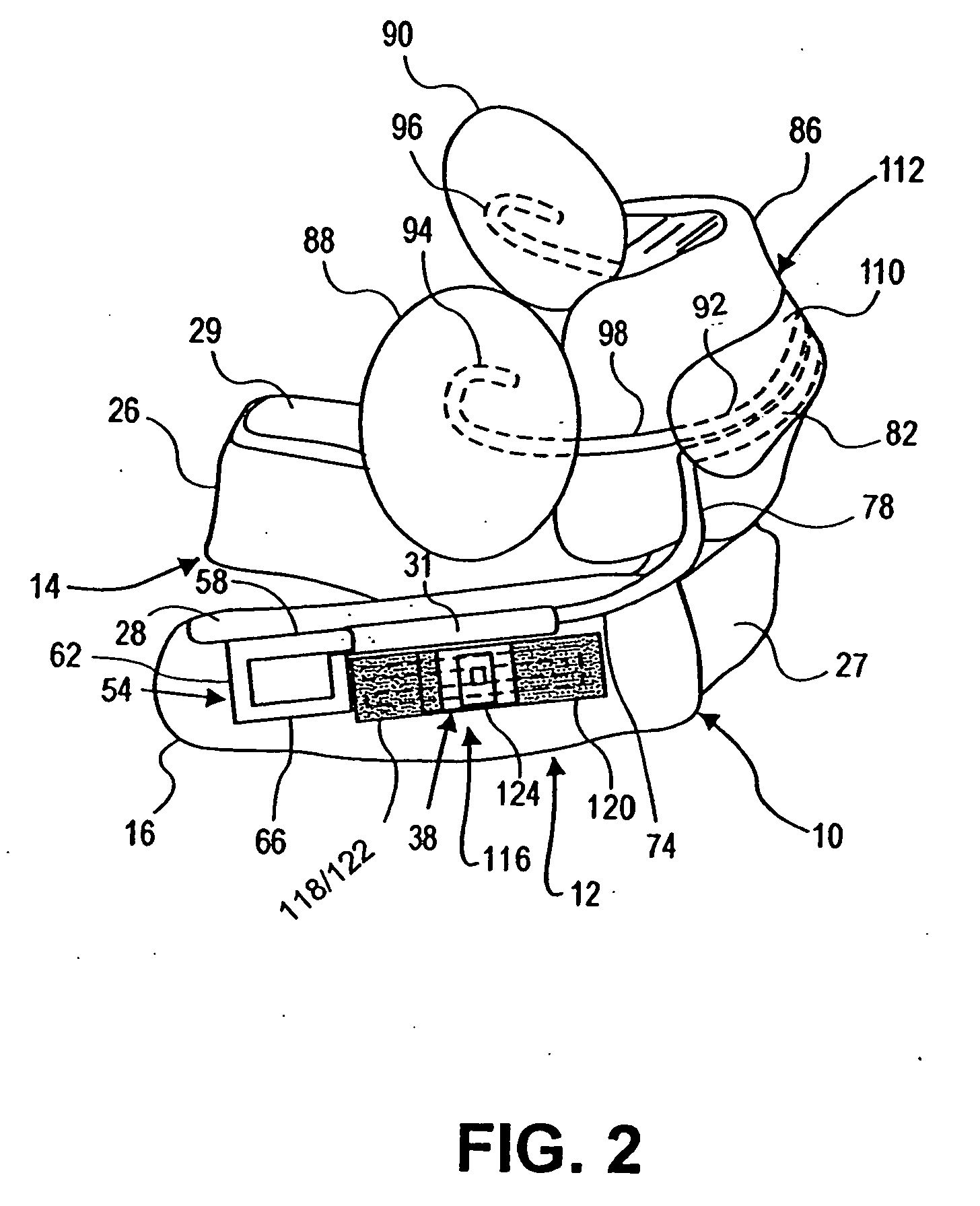 Method for treating sleep apnea