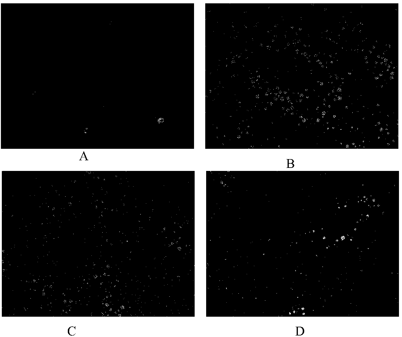 Traditional Chinese medicine composition for treating fatty liver and application thereof