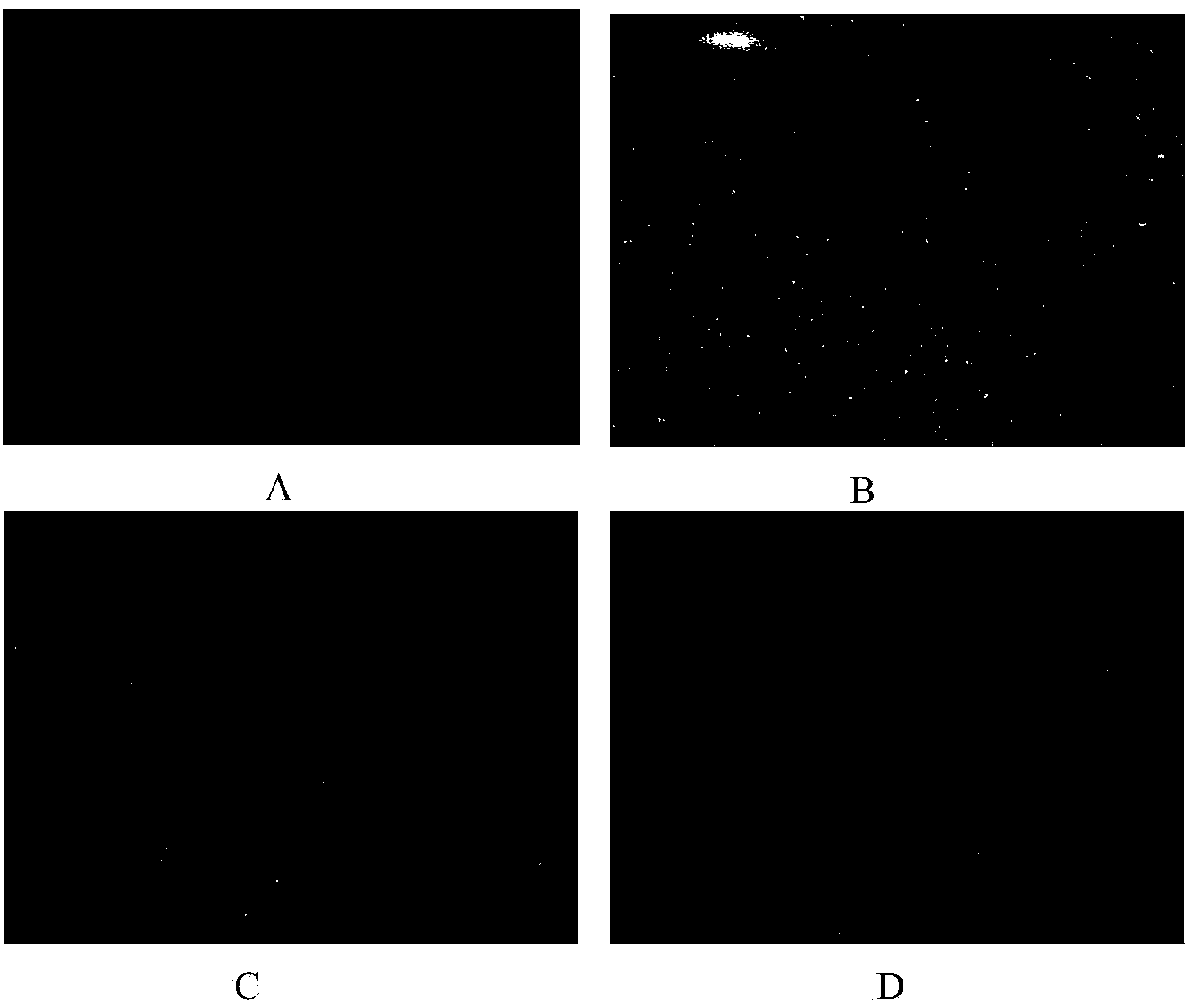 Traditional Chinese medicine composition for treating fatty liver and application thereof