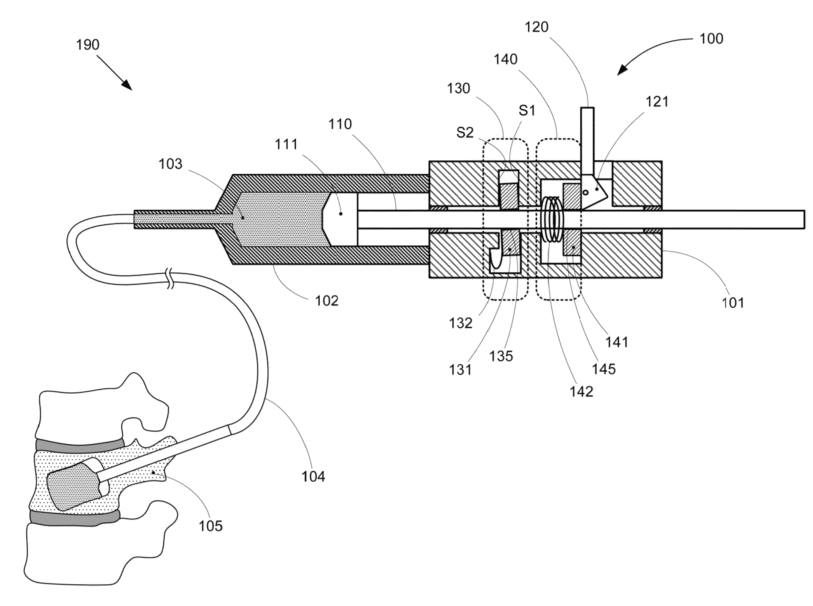 High pressure surgical system