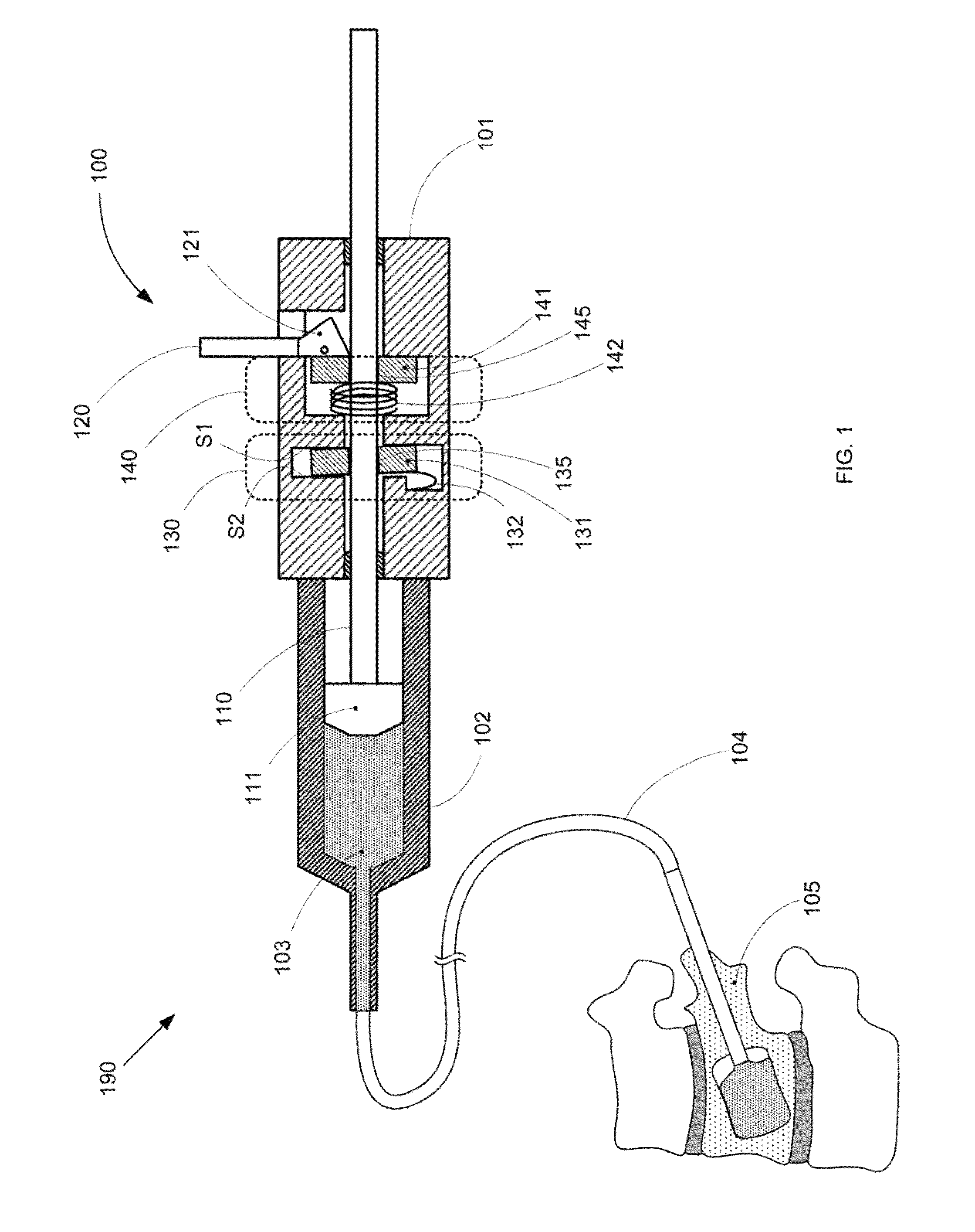 High pressure surgical system