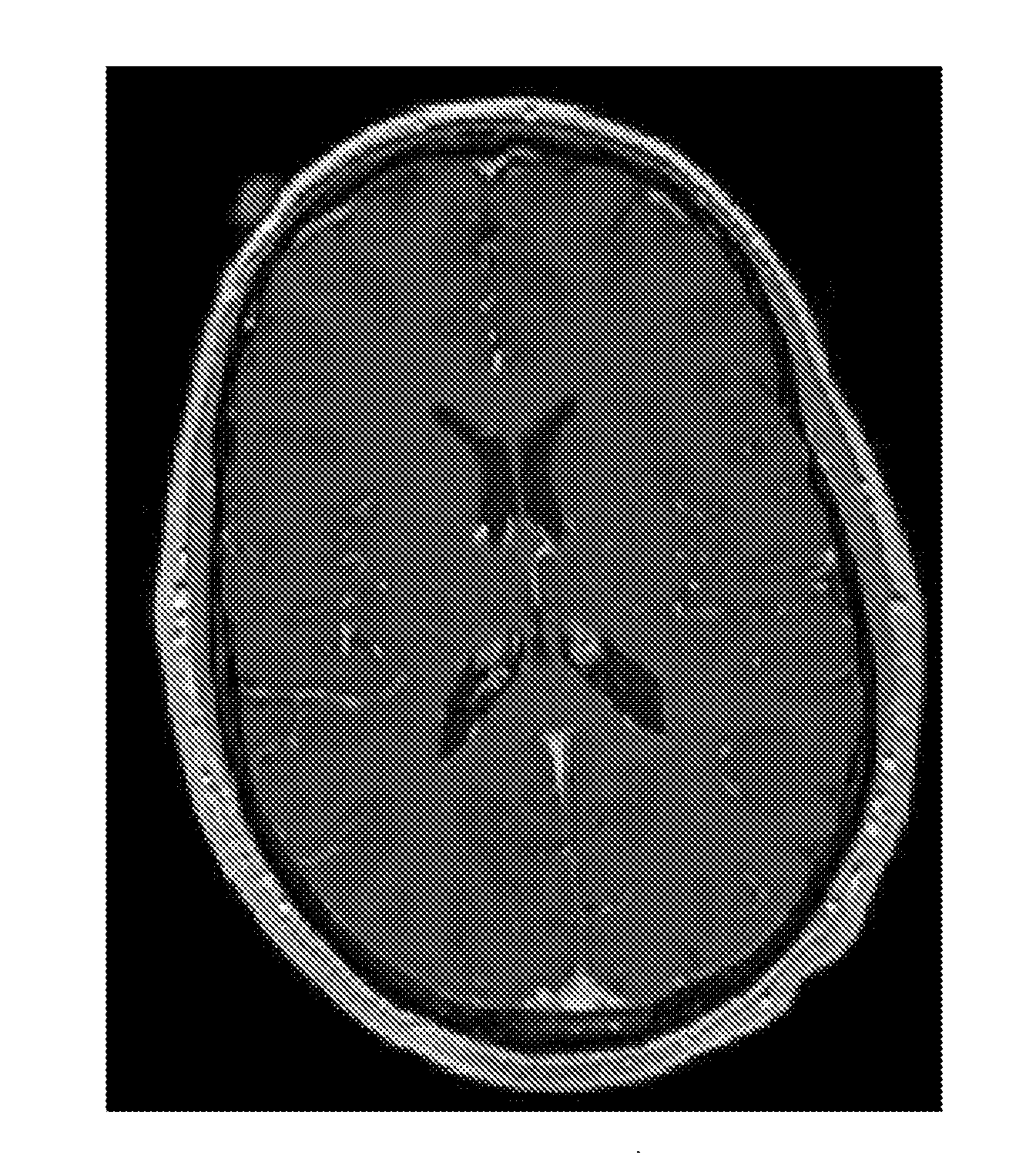 Automated trajectory planning for stereotactic procedures