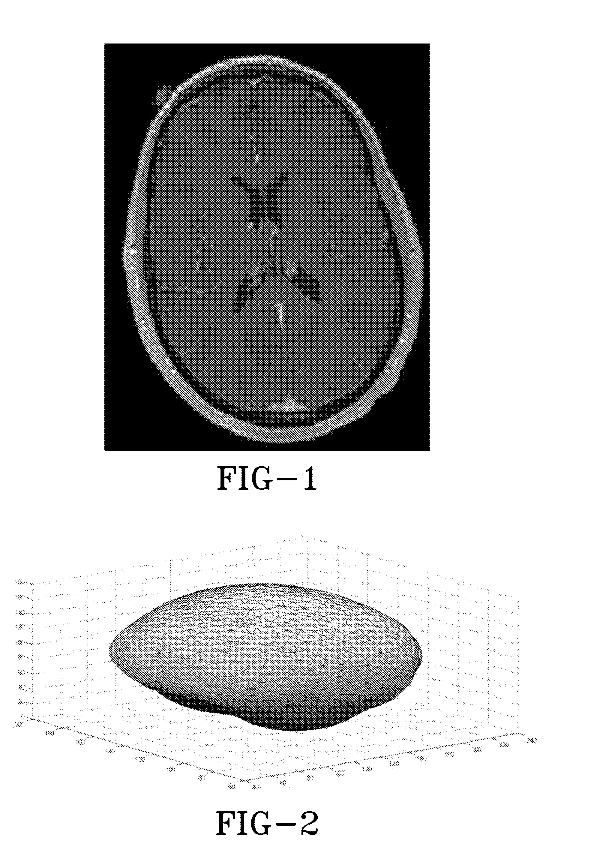 Automated trajectory planning for stereotactic procedures