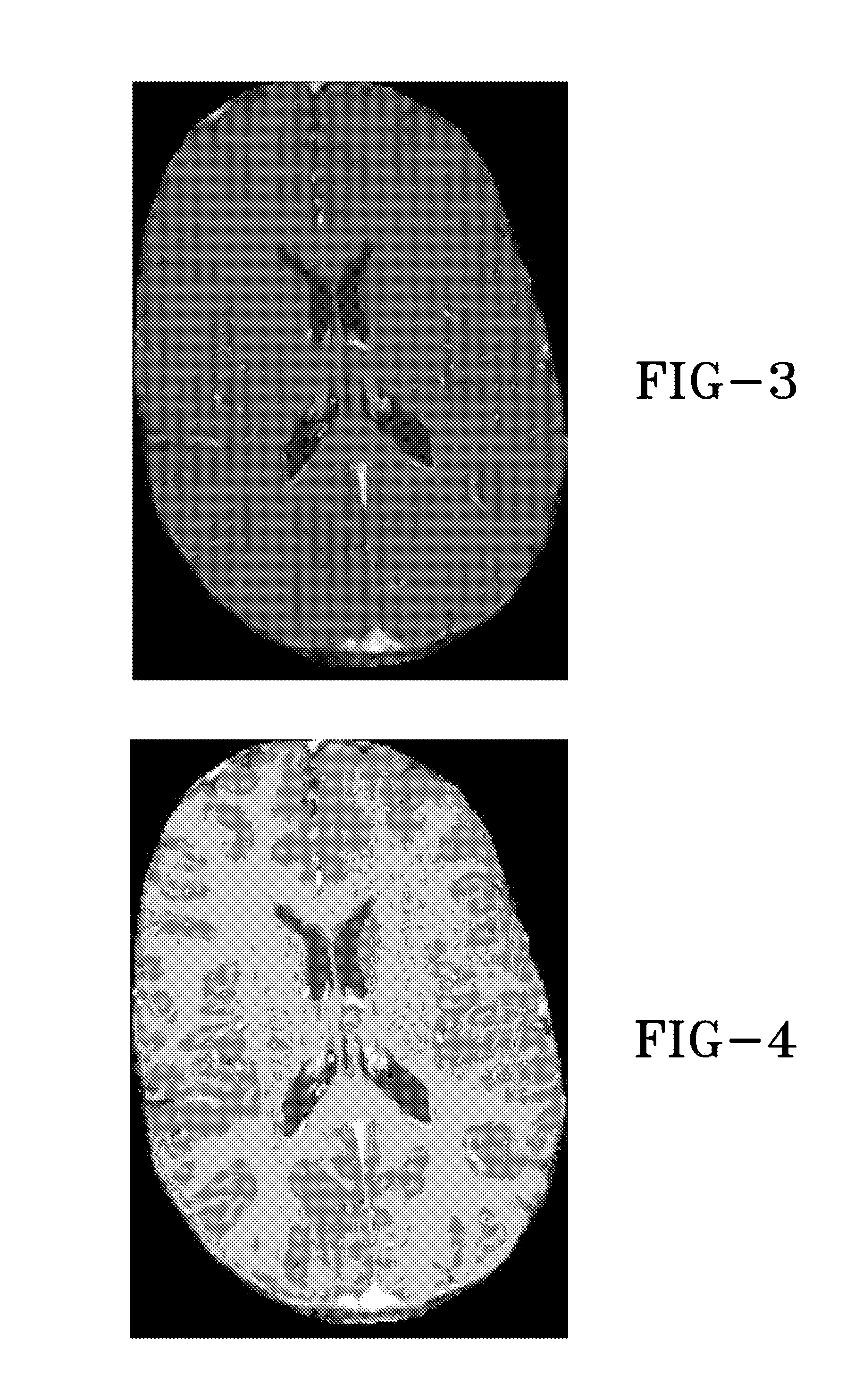 Automated trajectory planning for stereotactic procedures