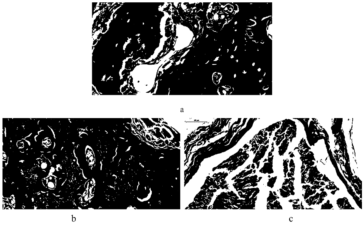 Plastic DBM (decalcified bone matrix) bone induced self-curing bone grafting material and preparation method thereof