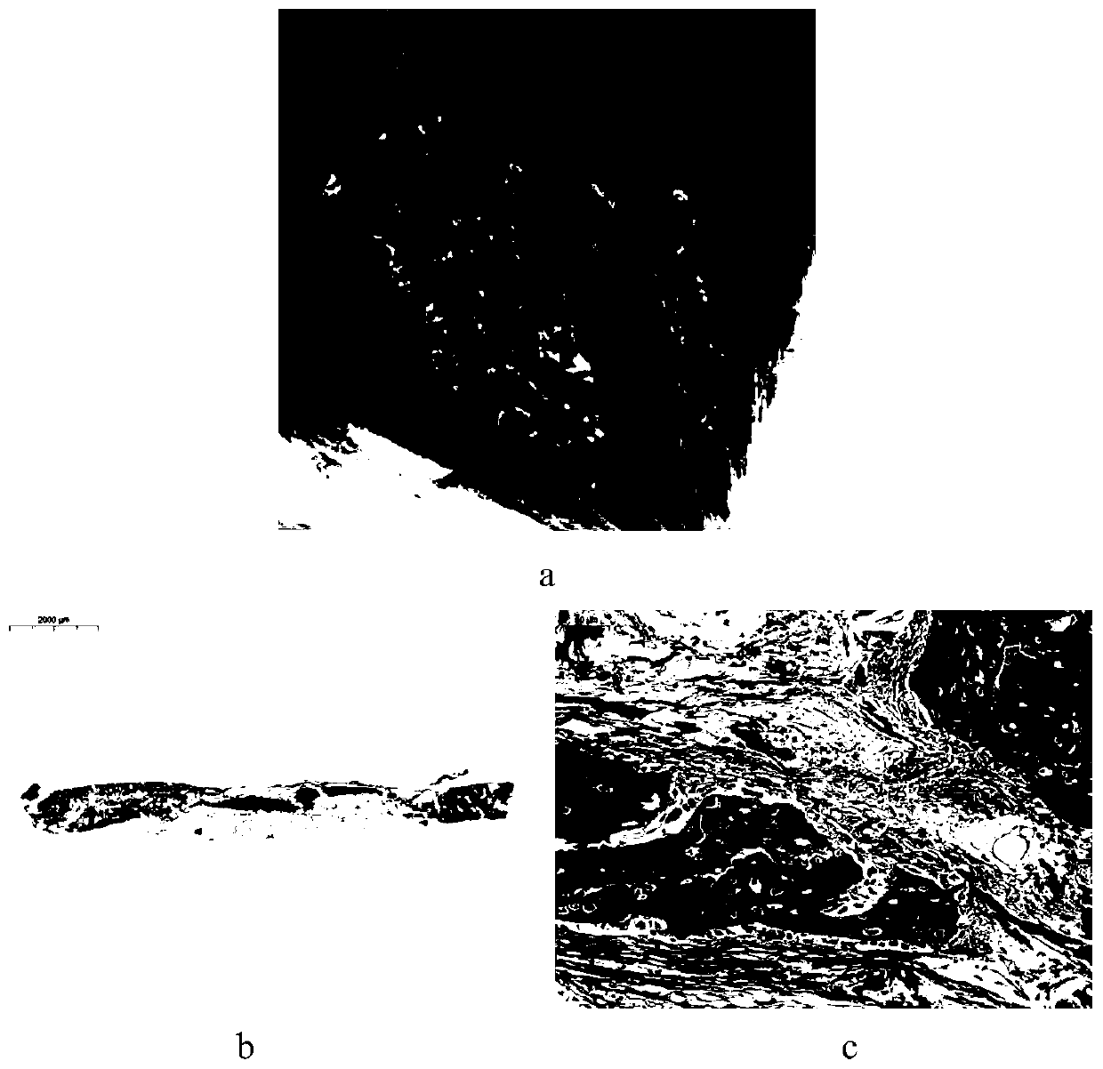 Plastic DBM (decalcified bone matrix) bone induced self-curing bone grafting material and preparation method thereof