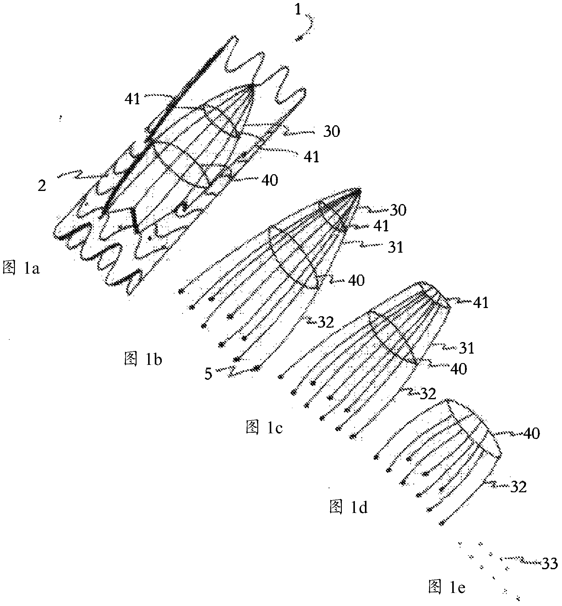 Absorbable vascular filter