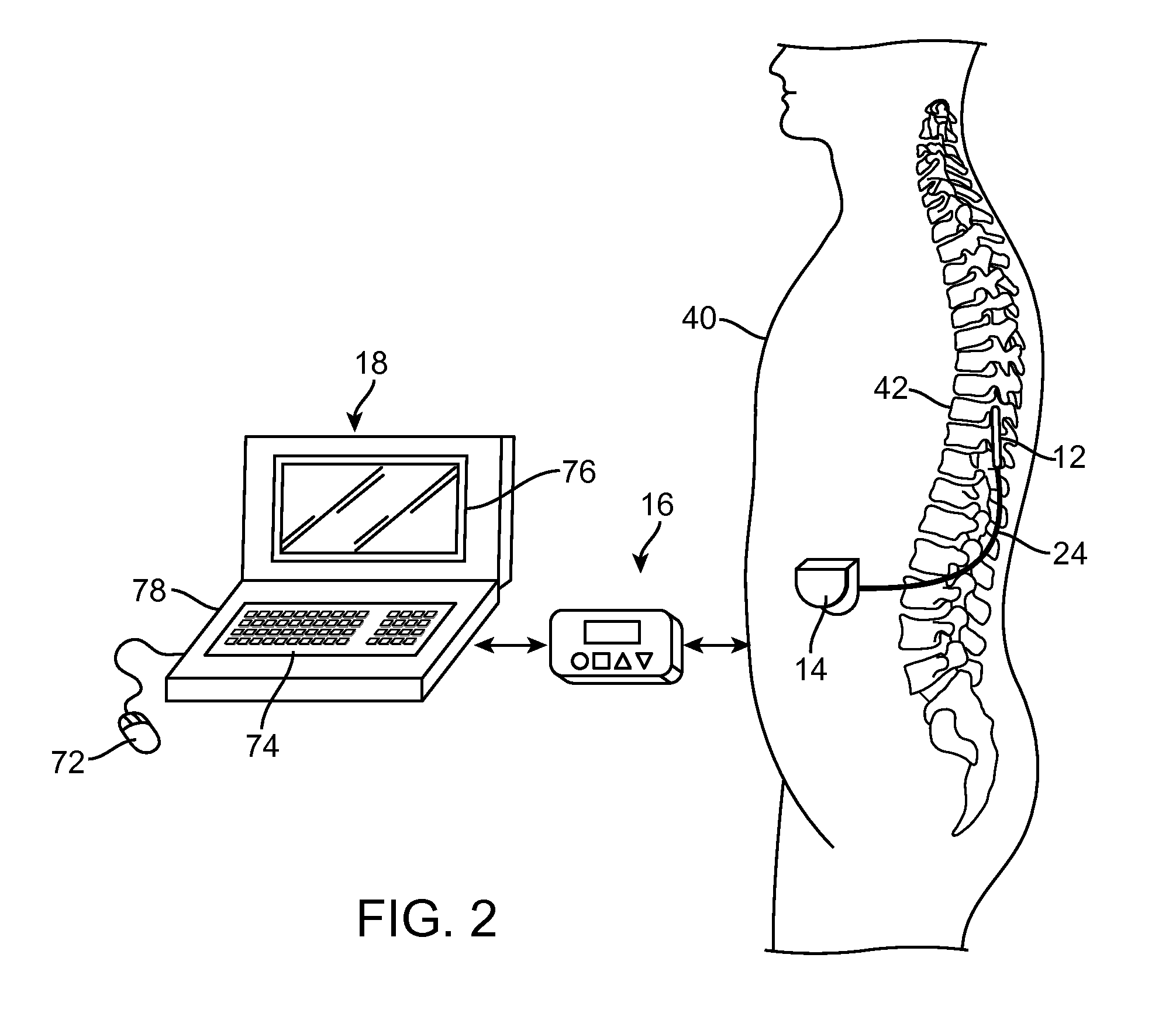 Seamless integration of different programming modes for a neurostimulator programming system