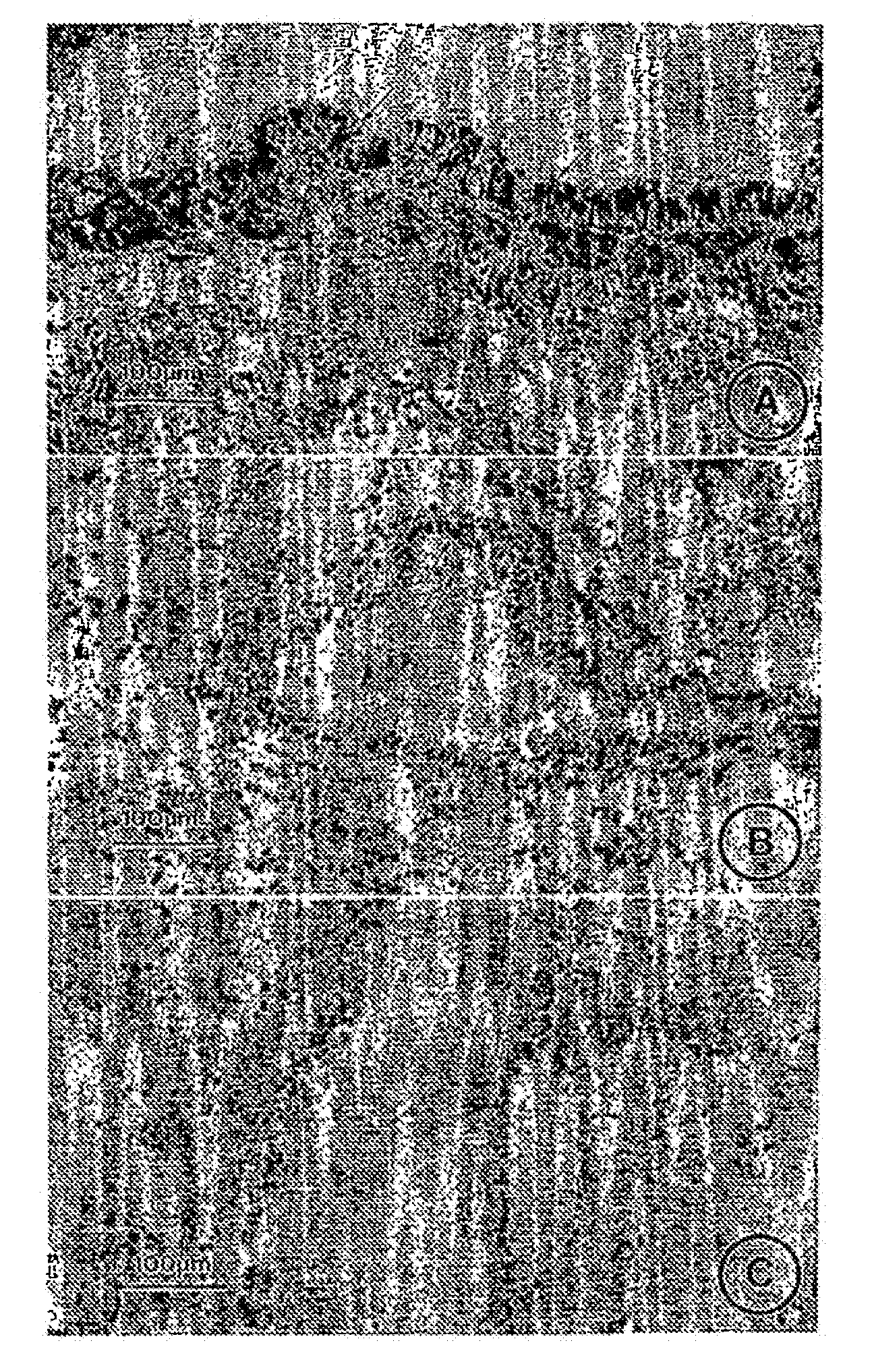 Methods relating to the treatment of fibrosis