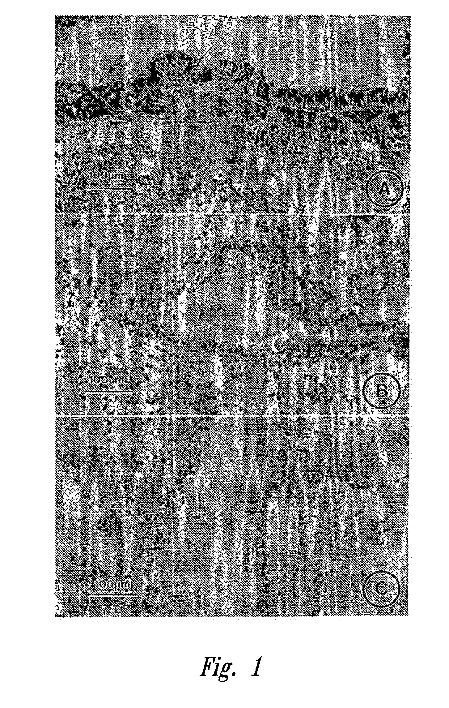 Methods relating to the treatment of fibrosis