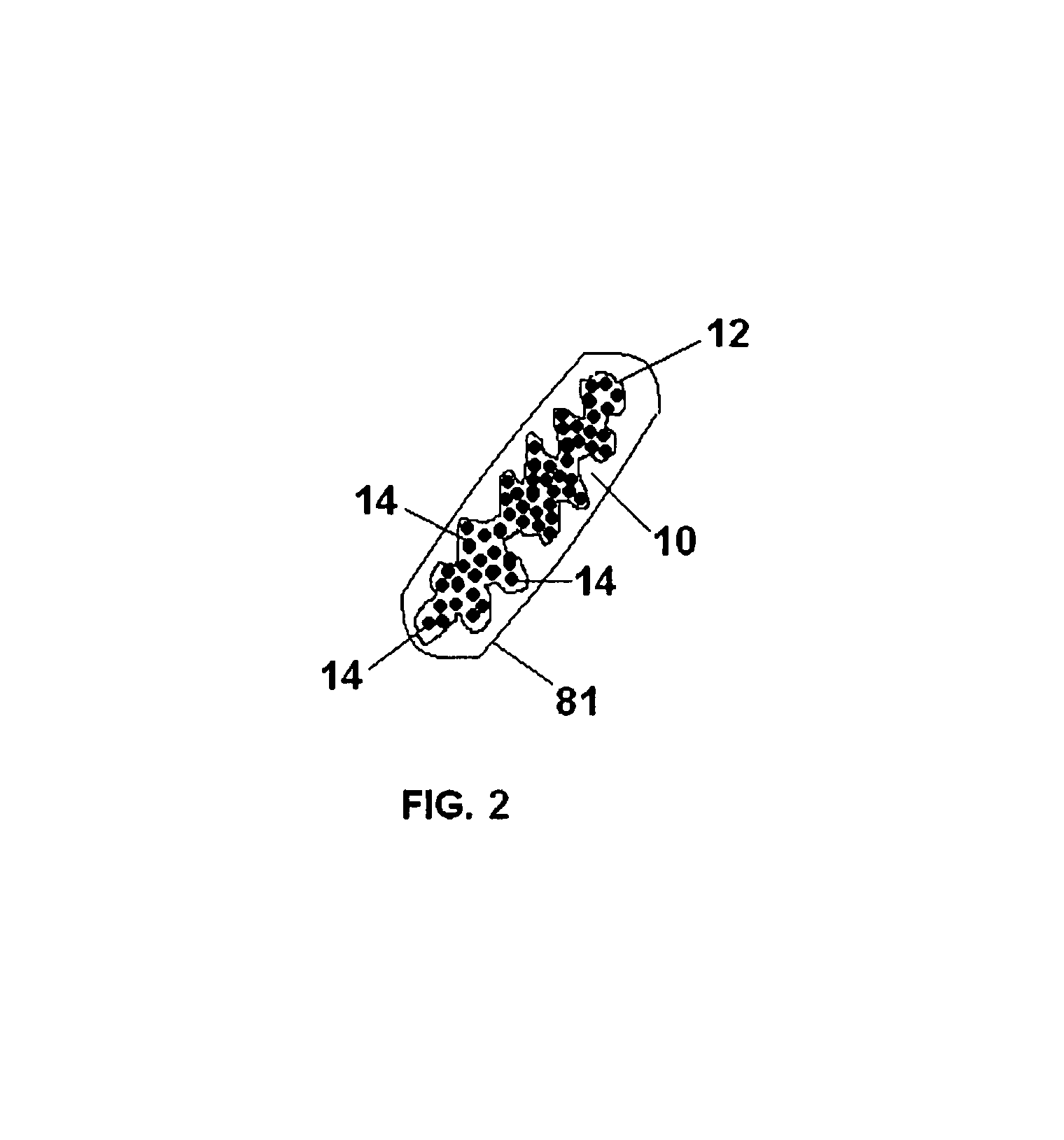 Ingestible implement for weight control