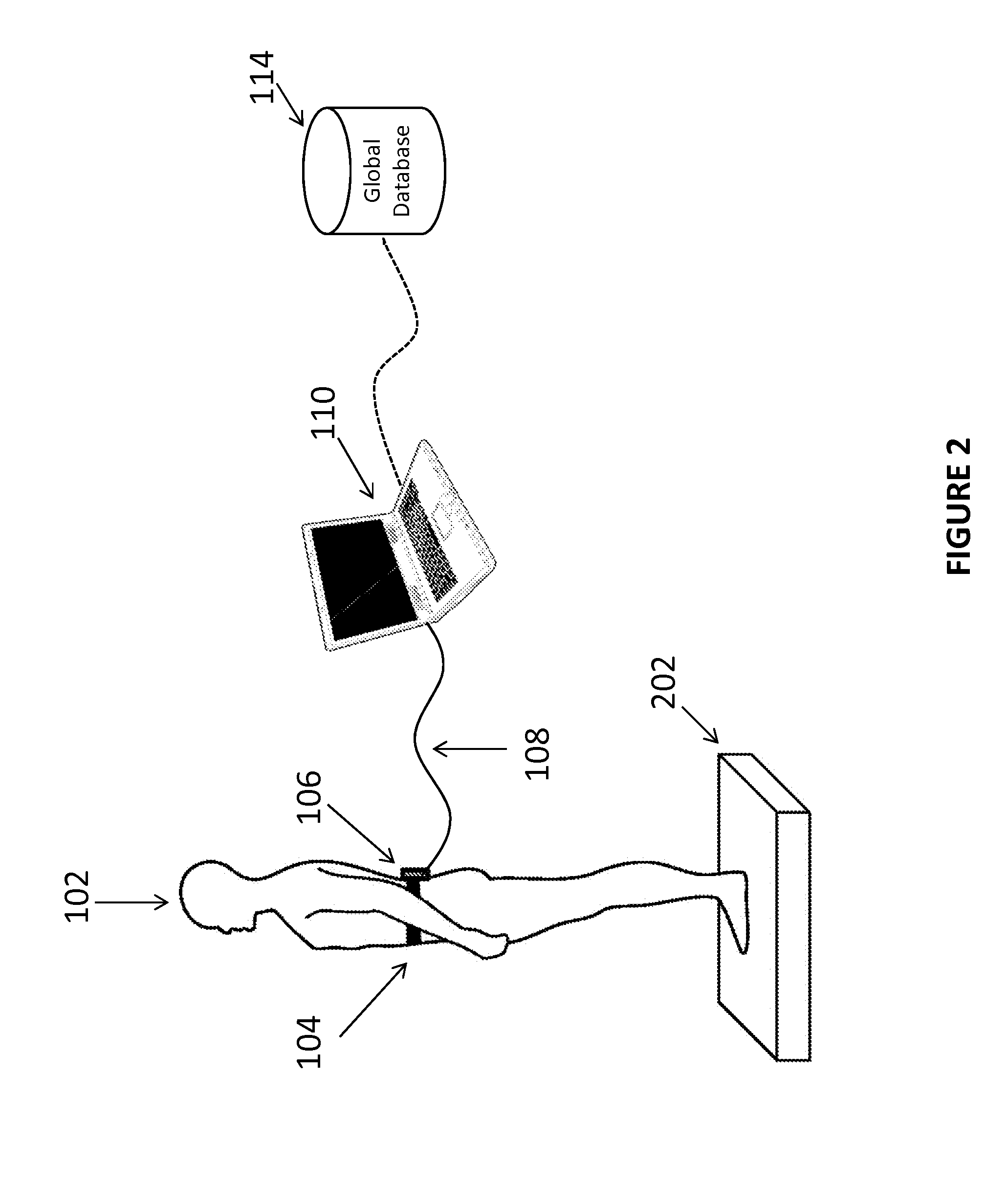 System and Method for Evaluating Concussion Injuries