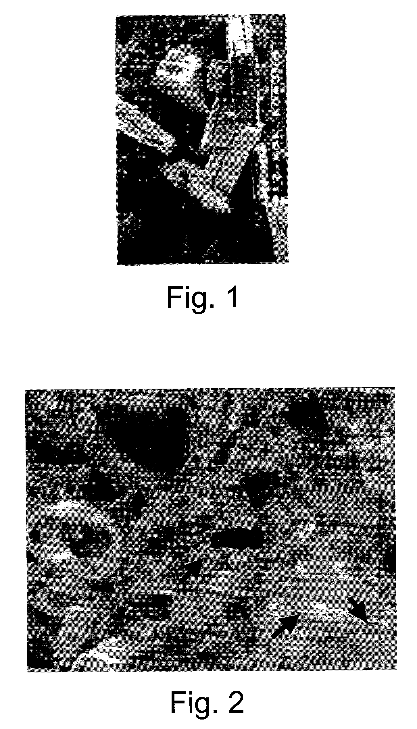 Method for the treatment of pozzolanic materials