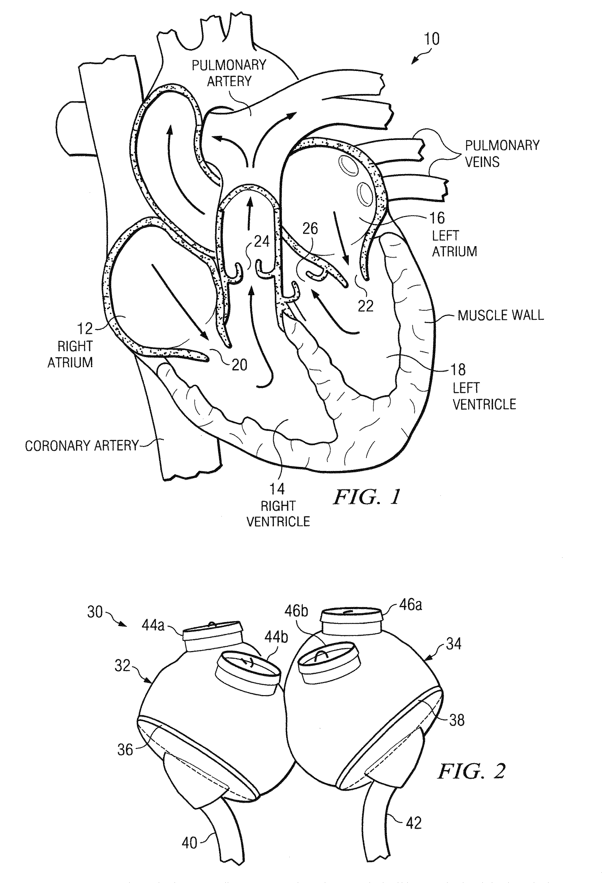 Scotch-yoke mechanism for redundant actuation applications