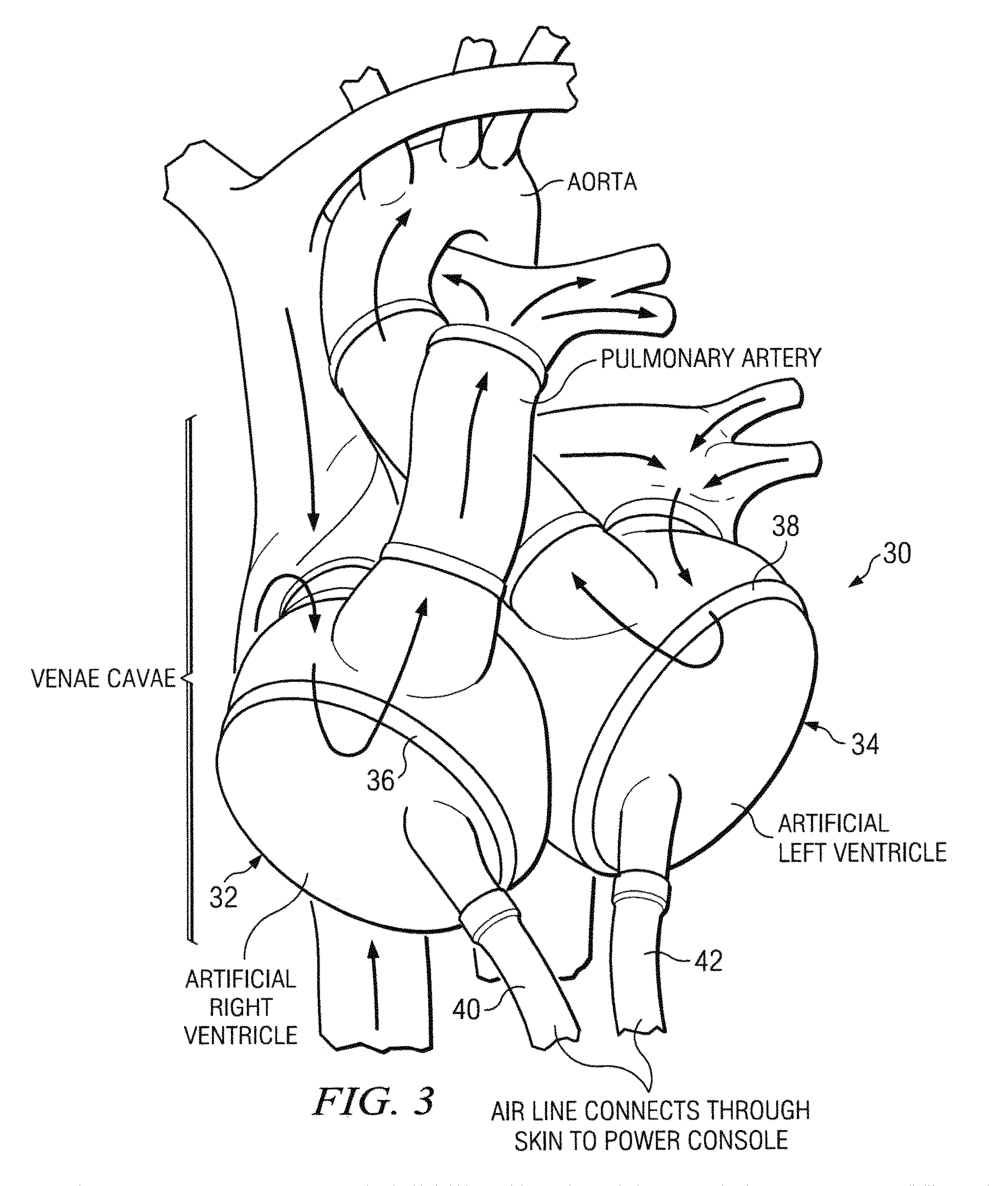 Scotch-yoke mechanism for redundant actuation applications