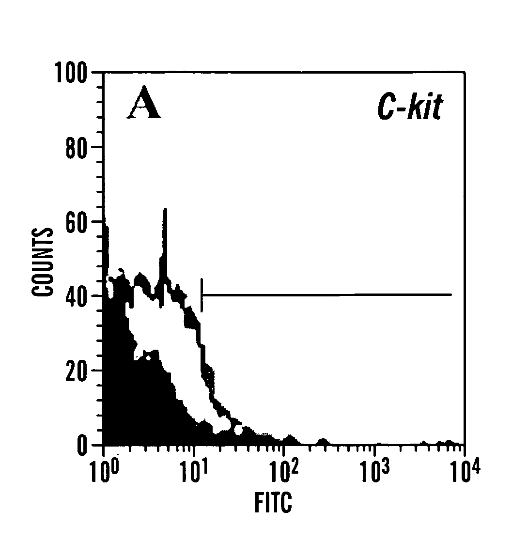 Methods of isolation, expansion and differentiation of fetal stem cells from chorionic villus, amniotic fluid, and placenta and therapeutic uses thereof