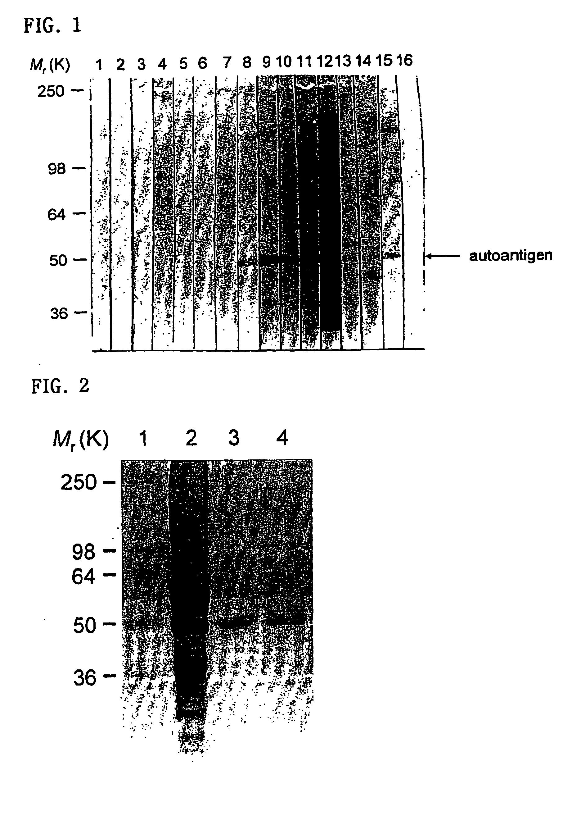 Detection of autoantibodies to cytokeratin 18 protein in patients with bronchial asthma and chronic rhinitis, and its applications including a kit for diagnosing bronchial asthma and chronic rhinitis comprising mammalian cytokeratin 18 protein