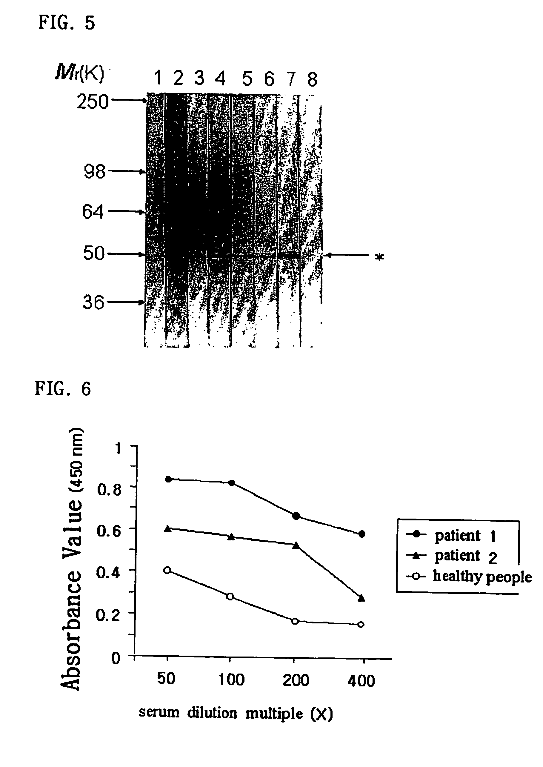 Detection of autoantibodies to cytokeratin 18 protein in patients with bronchial asthma and chronic rhinitis, and its applications including a kit for diagnosing bronchial asthma and chronic rhinitis comprising mammalian cytokeratin 18 protein