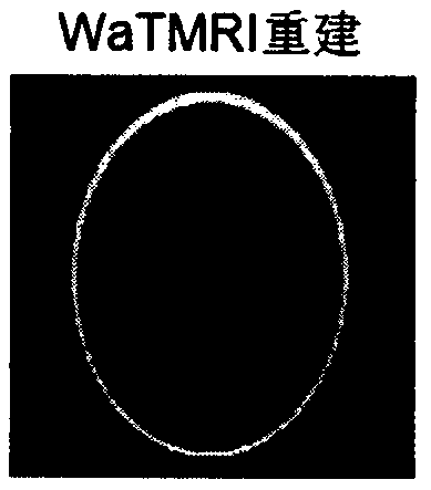 Compressed sensing low-field magnetic resonance imaging algorithm