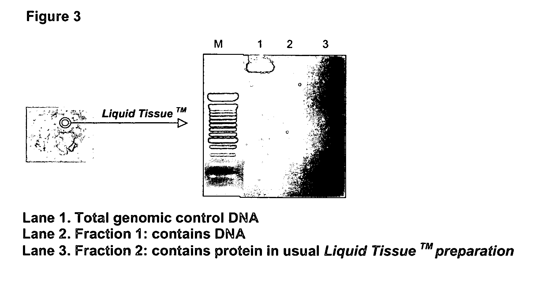 Liquid tissue preparation from histopathologically processed biological samples, tissues and cells