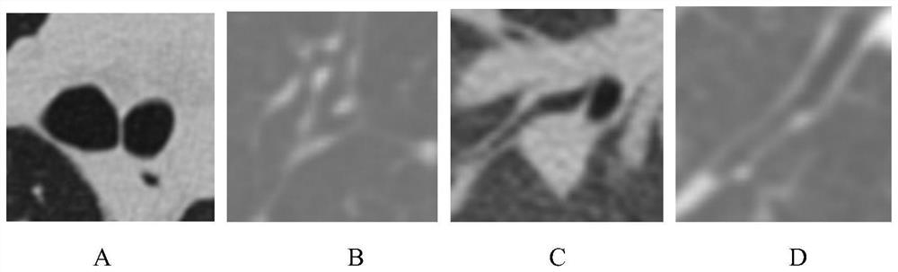 A Method for Automatic Tracheal Tree Extraction from Chest CT Images