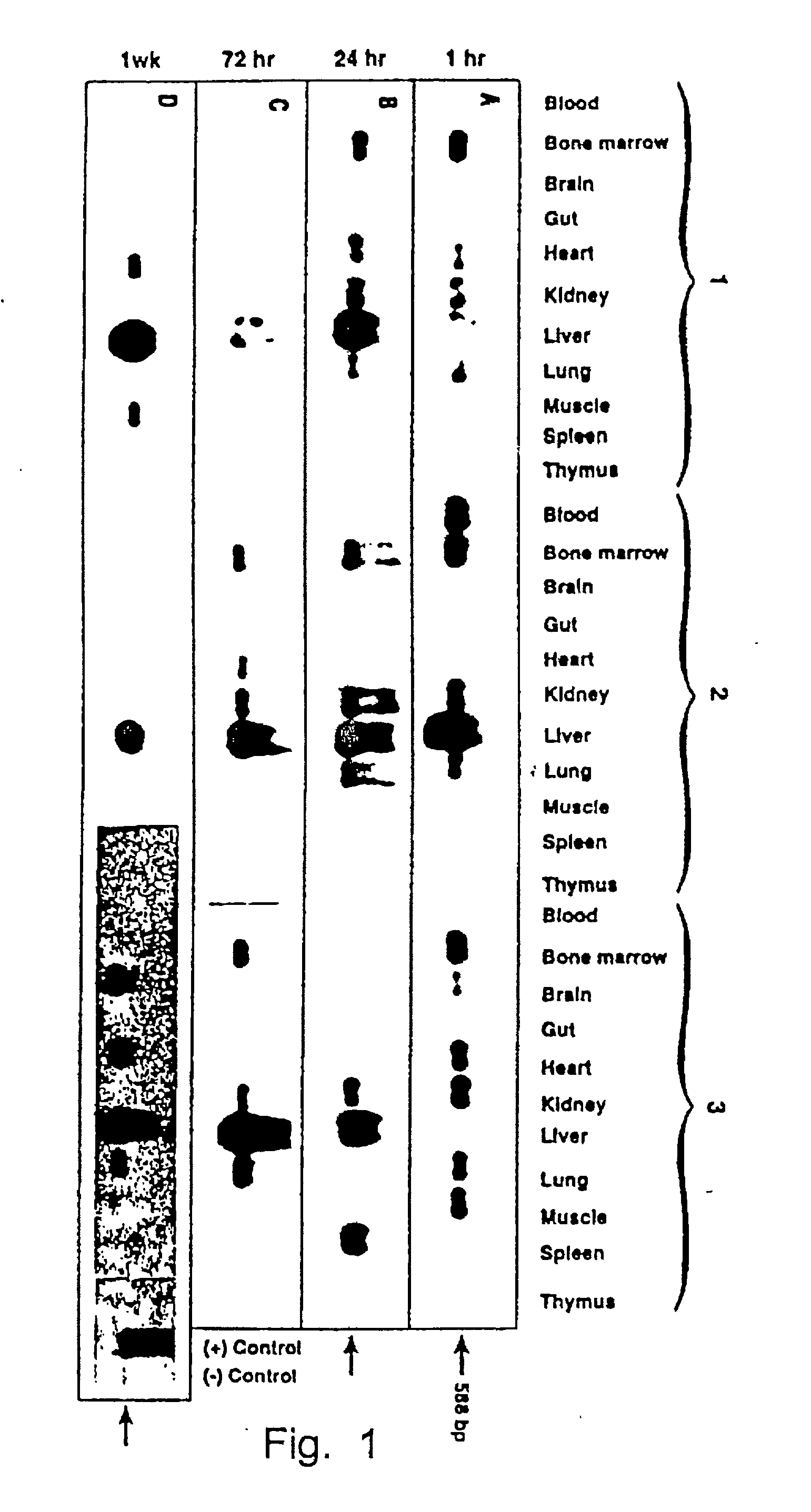 Methods and compositions for liver specific delivery of therapeutic molecules using recombinant AAV vectors