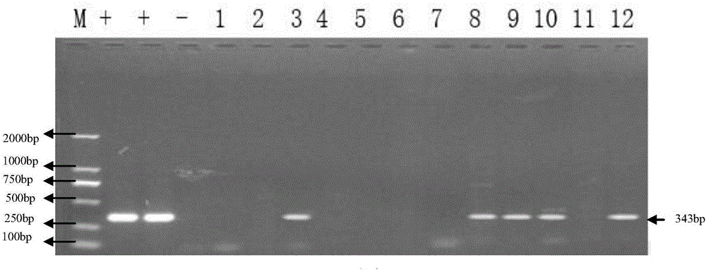 Primer for PCR (polymerase chain reaction) diagnosis of wild porcine parvovirus infection, kit with primer for PCR diagnosis of wild porcine parvovirus infection and application of primer and kit