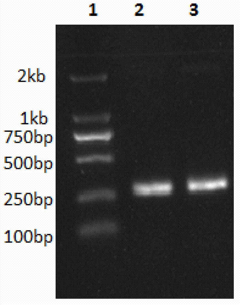 Metallothionein transgenic yeast construction and heavy metal adsorbing material preparation method by utilizing metallothionein transgenic yeast