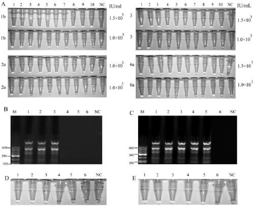 Hepatitis C virus genotyping method based on loop-mediated isothermal amplification