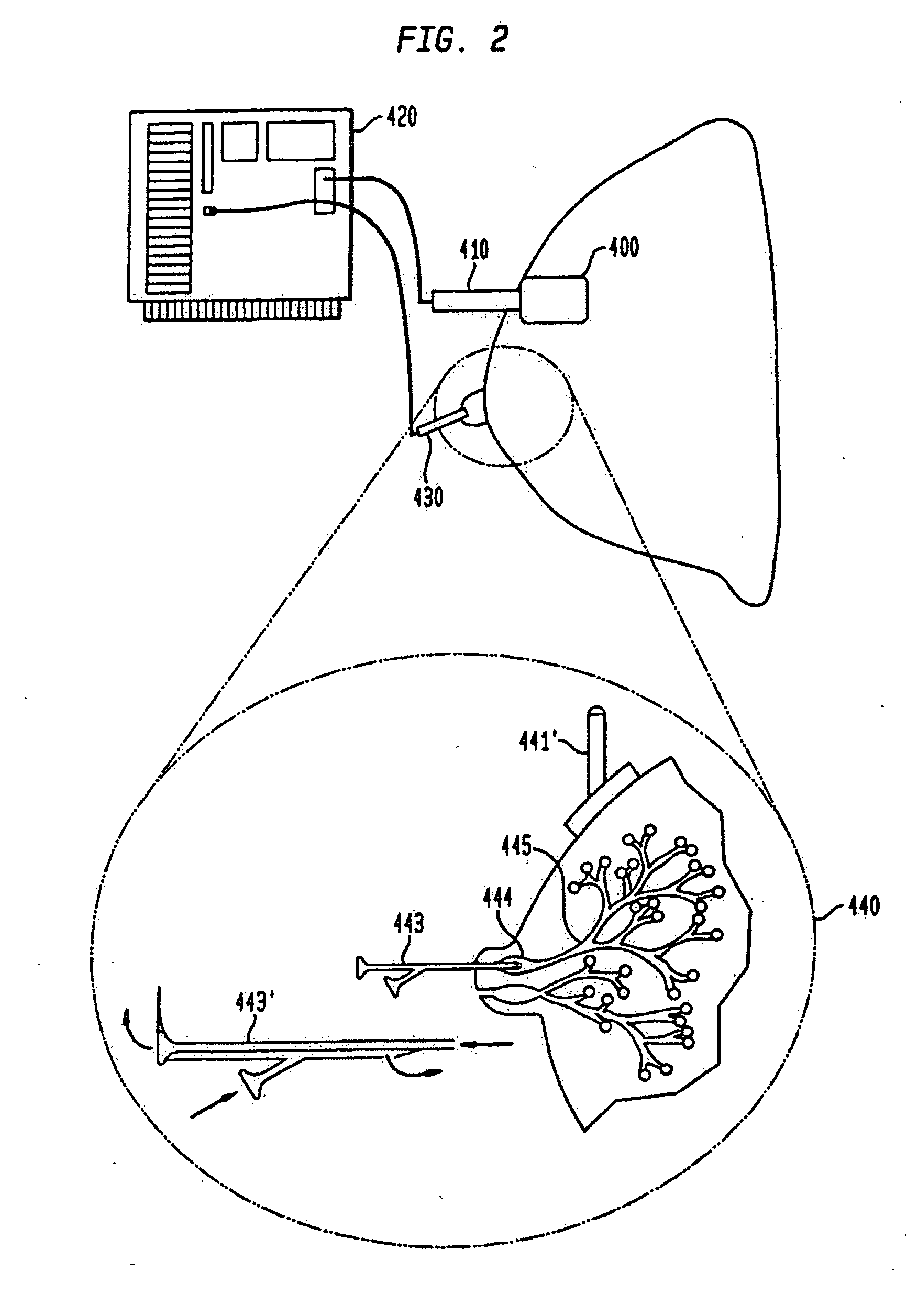 Method and system for detecting electrophysiological changes in pre-cancerous and cancerous tissue and epithelium