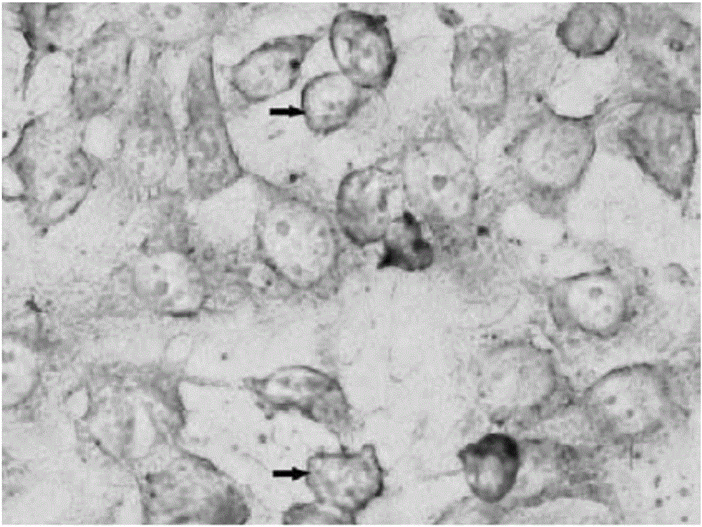 Corneal limbus stem cell, and culture method as well as application thereof