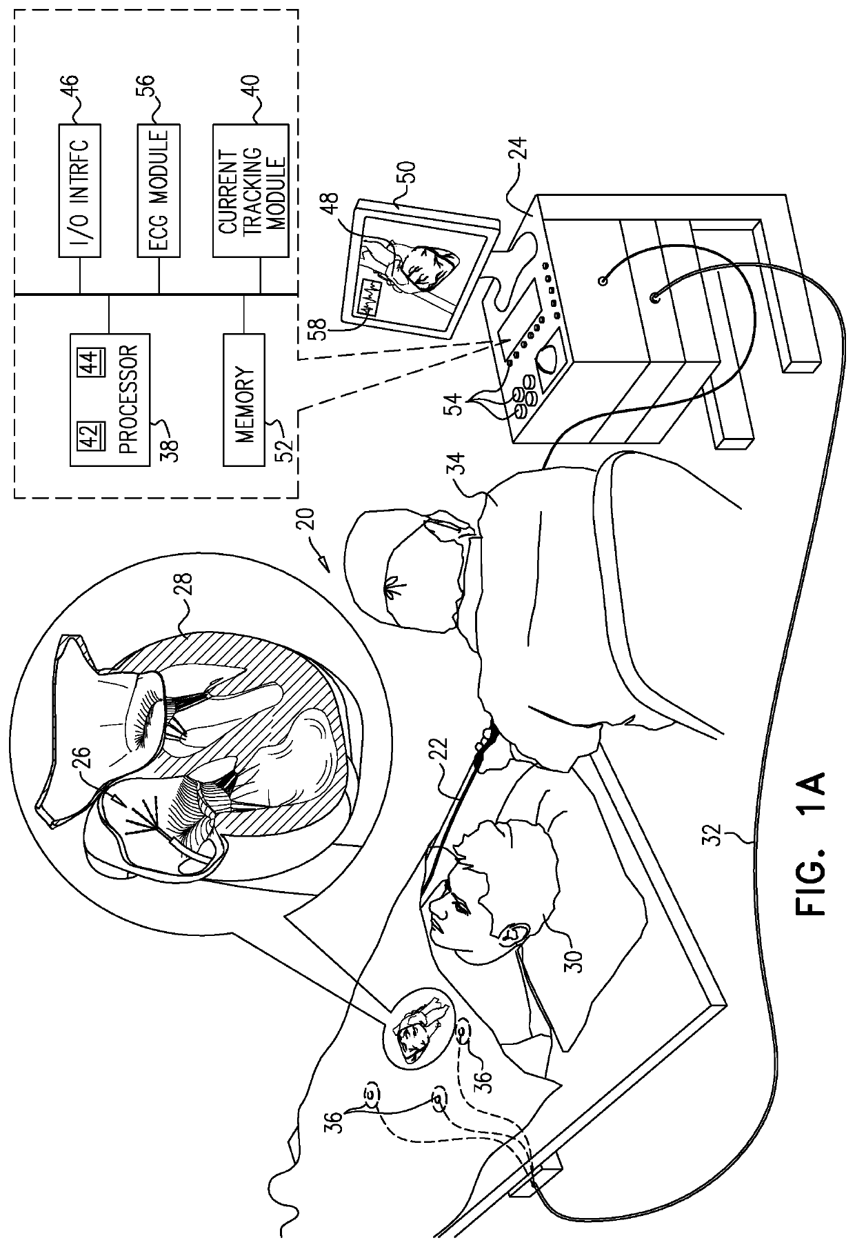 Mapping local activation times for sinus and non-sinus cardiac cycles