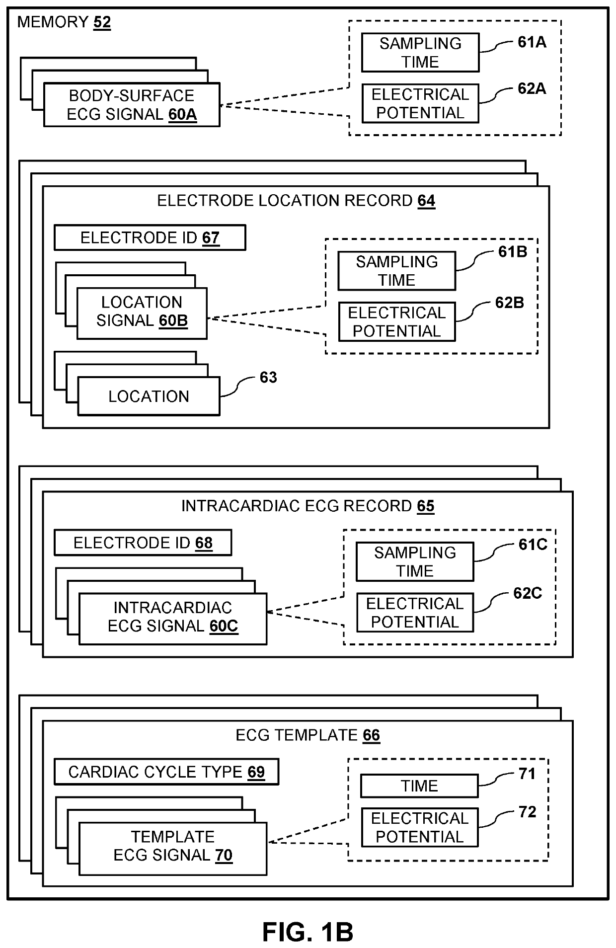 Mapping local activation times for sinus and non-sinus cardiac cycles