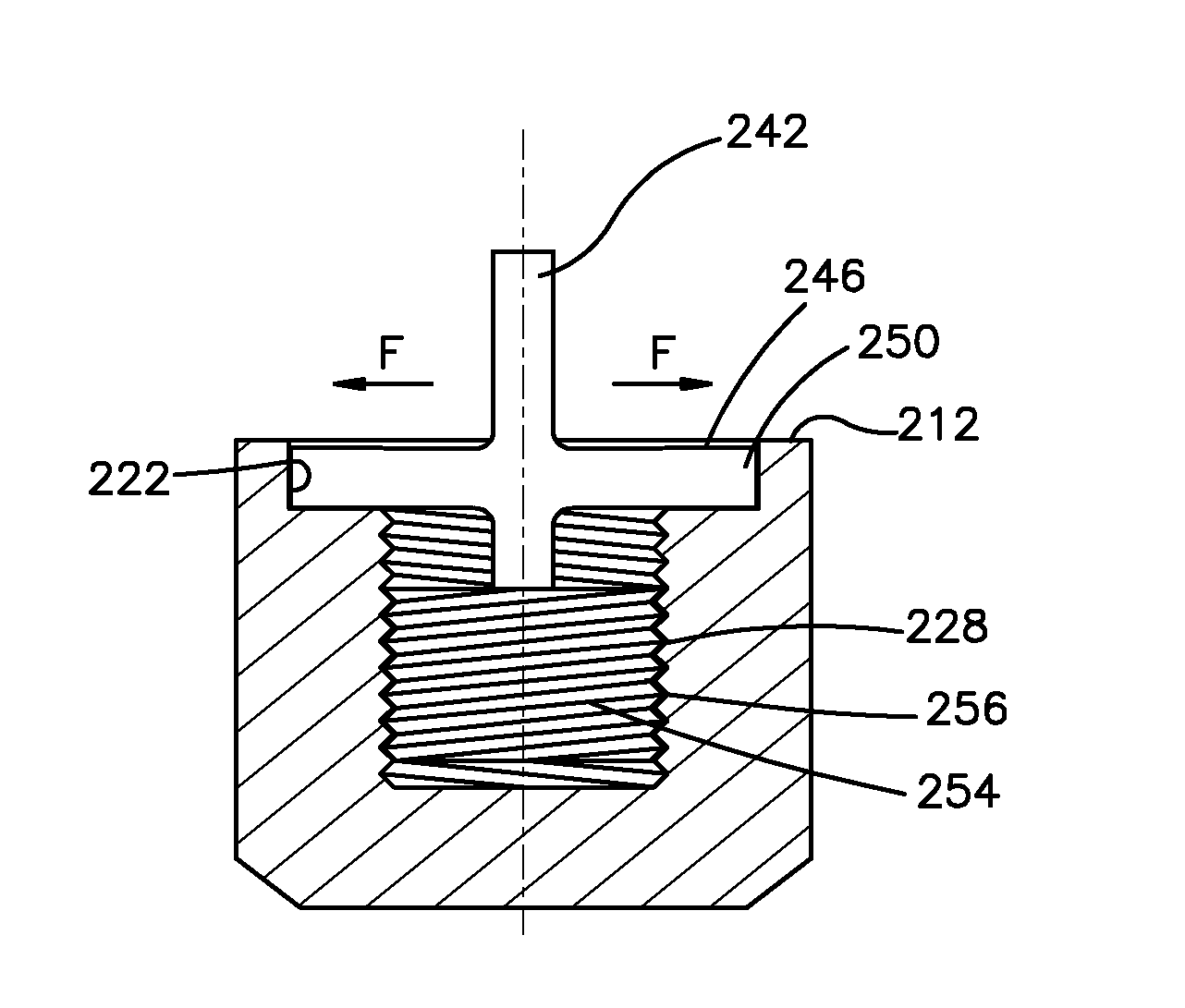 Method and apparatus for treatment of bones