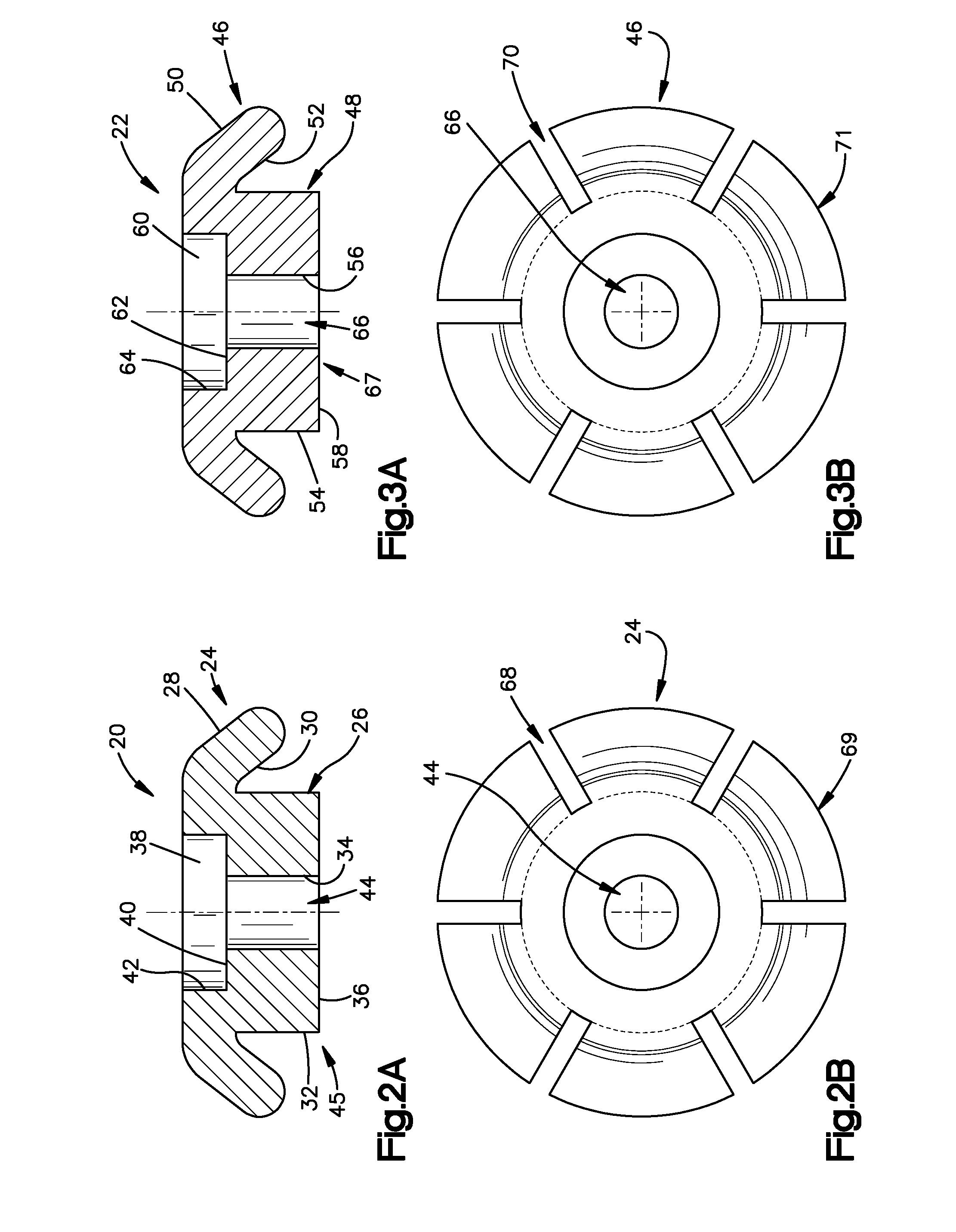 Method and apparatus for treatment of bones