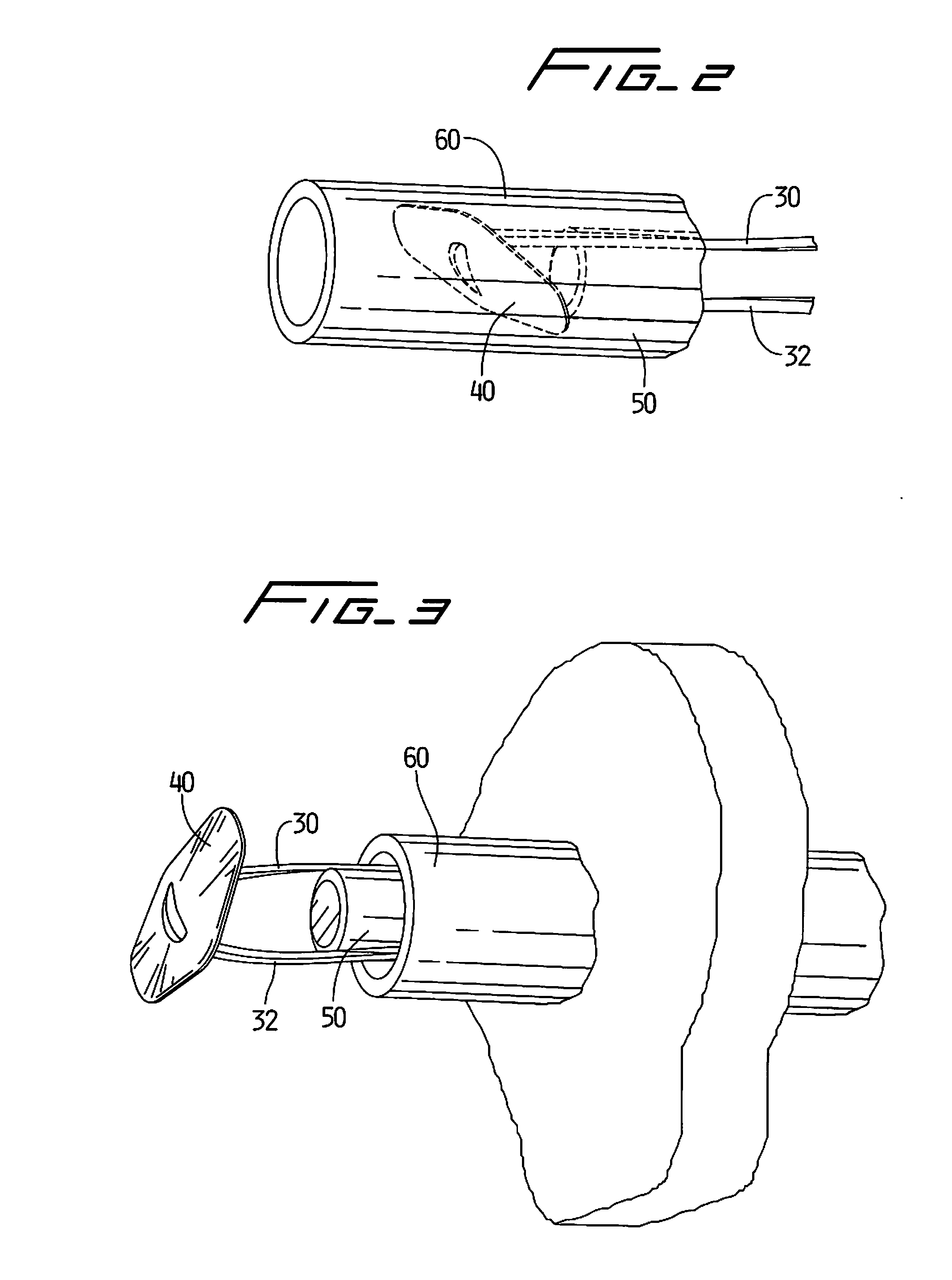 Vascular Hole Closure Device