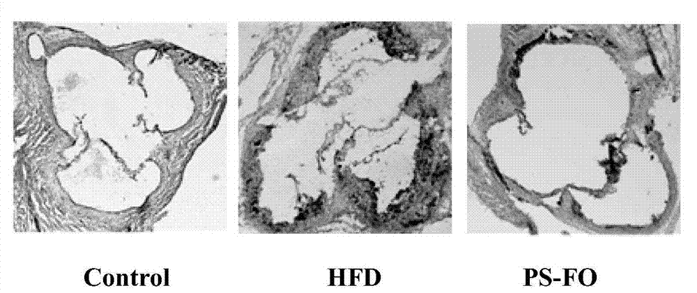 Functional grease composition with improvement effects on atherosclerosis