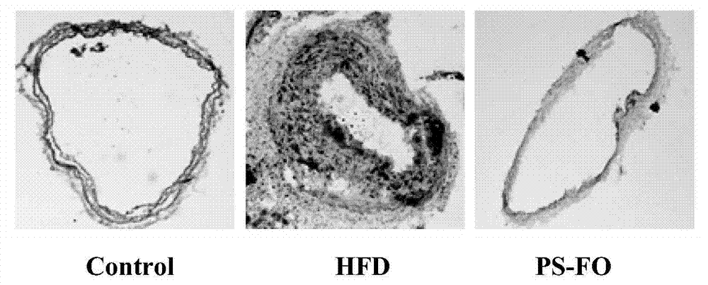 Functional grease composition with improvement effects on atherosclerosis