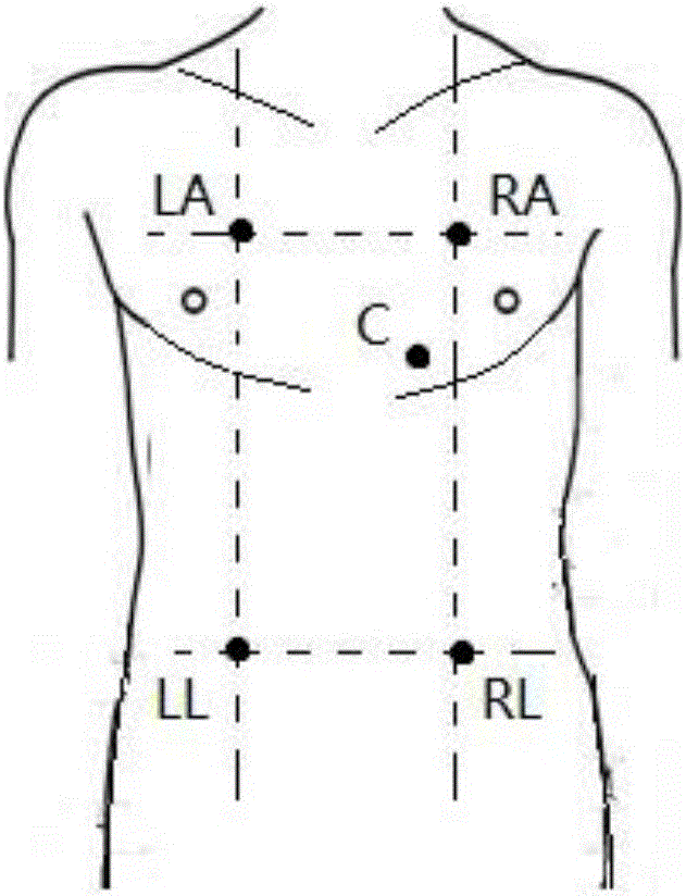 Integrated wearable multi-physiological index acquisition equipment