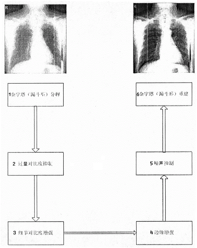 Method for enhancing medical X-ray image display effect