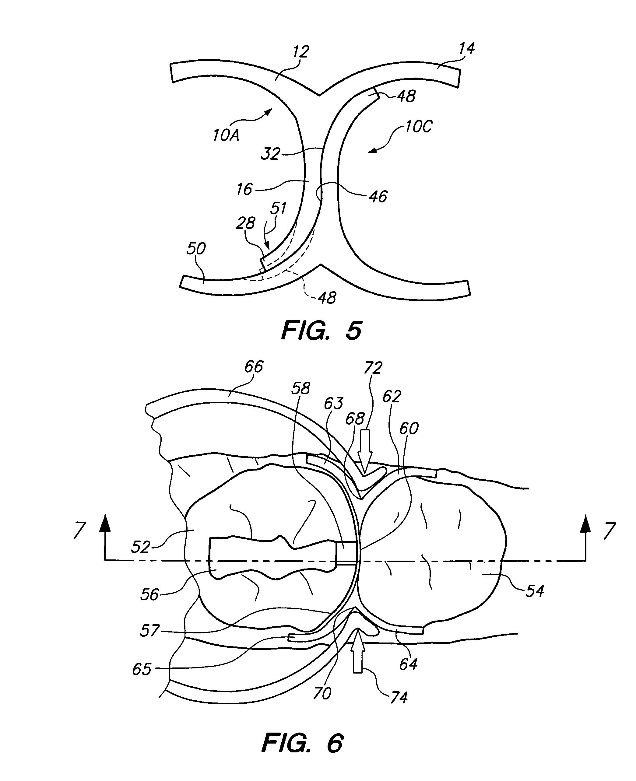 Dental wedge and former device