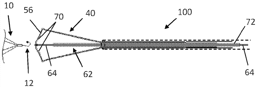 Ivc filter retrieval systems with releasable capture feature