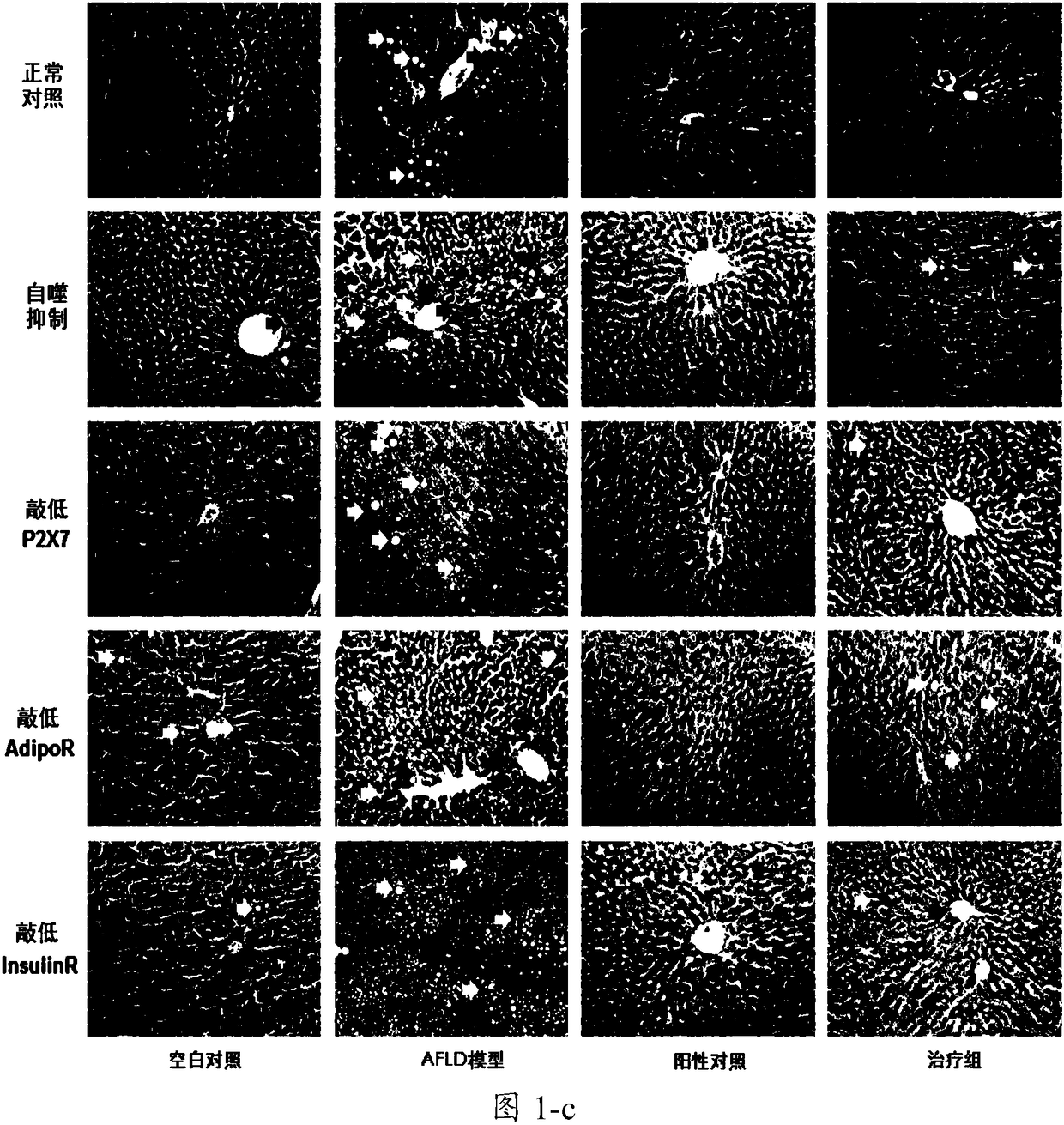 New mechanism of anti-alcoholic hepatic injury by wolfberry red element and application of hepatoprotective products