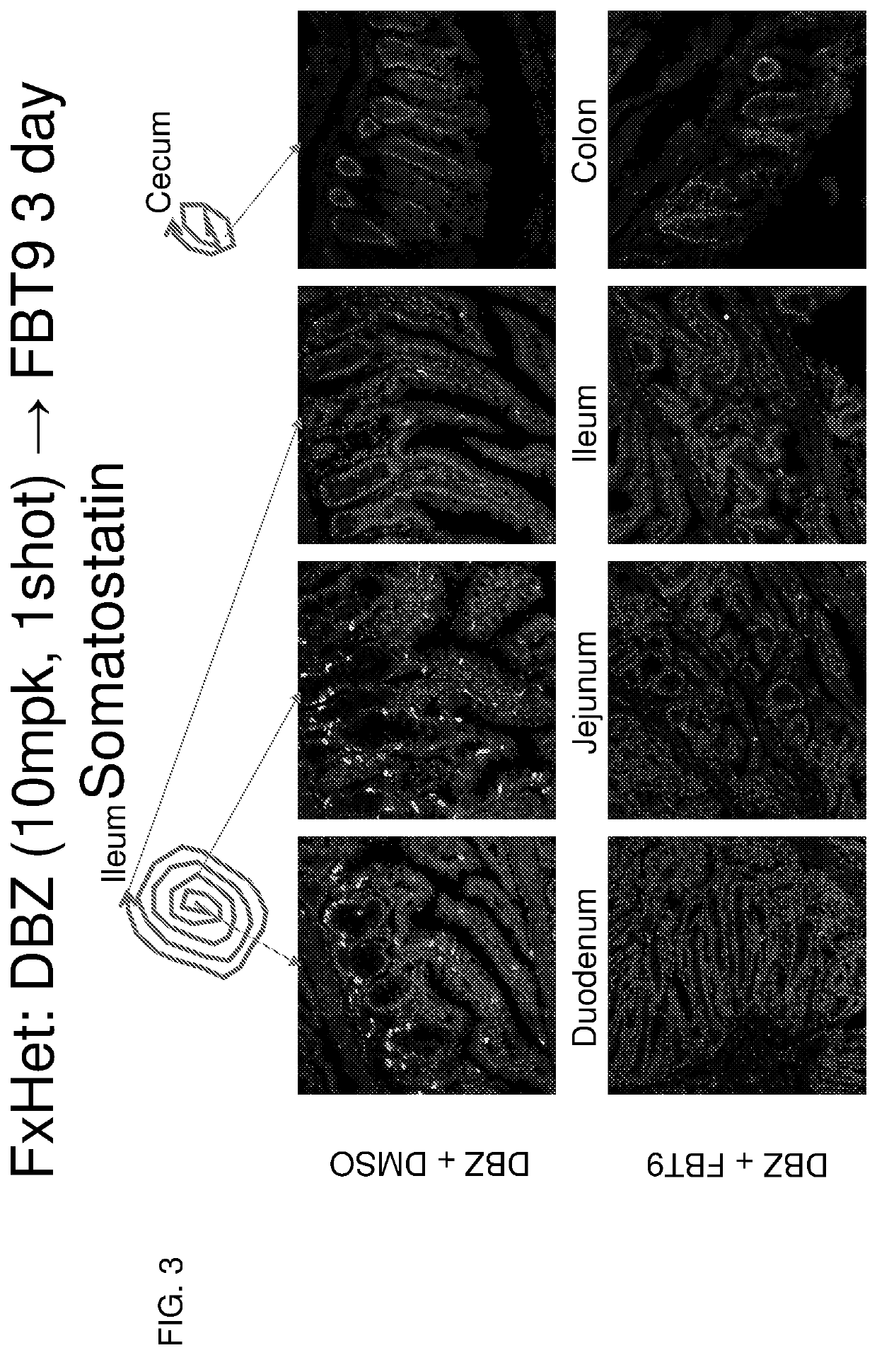 Co-Administration of inhibitors to produce insulin producing gut cells