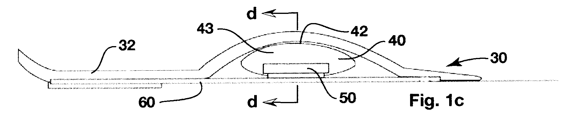 Dynamic arch stabilization and rehabilitative shoe midsole/insole device