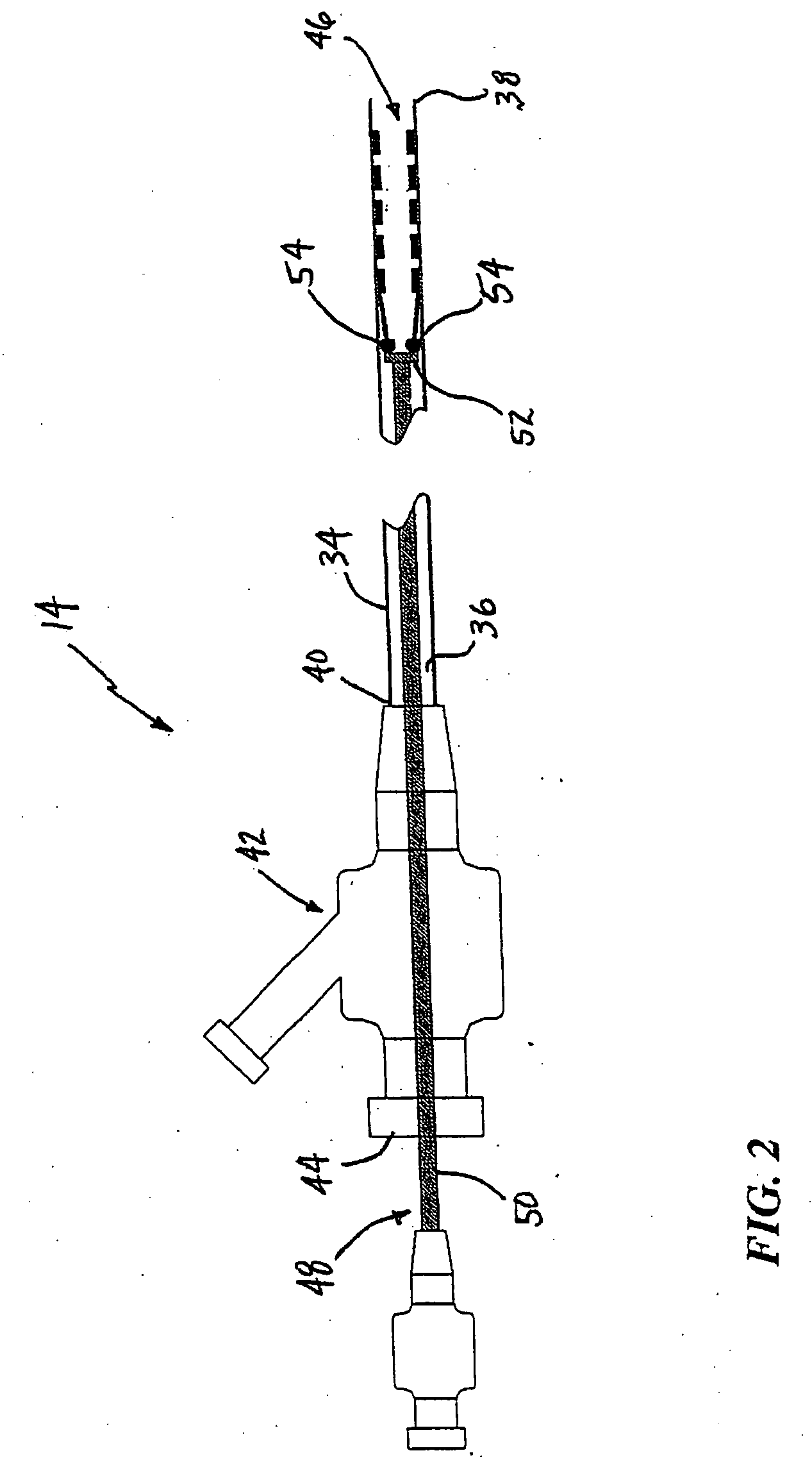 System and method for treating ischemic stroke